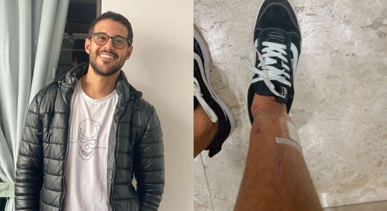 Rodrigo Mussi mostra cicatrizes na perna fraturada pela primeira vez