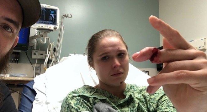 Ronda Rousey postou nas redes sociais o dedo fraturado