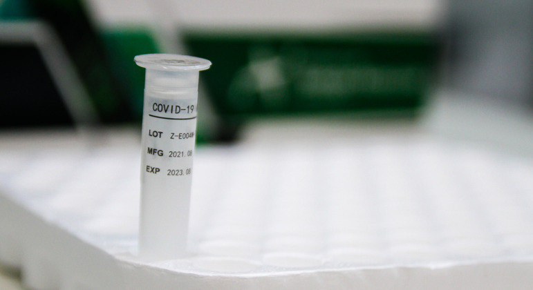 RT-PCR é mais preciso, mas requer estrutura laboratorial para ser processado