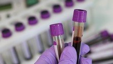 Cientistas apontam relação entre tipo sanguíneo e risco de doenças