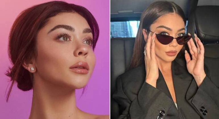 Sarah HylandA estrela da série Modern Family também passou por um transplante de rim. Ela tinha 21 anos quando recebeu o órgão do próprio pai. Hyland, hoje com 32 anos, sofria de uma doença chamada displasia renal, mas conseguiu se curar do problema com o transplante