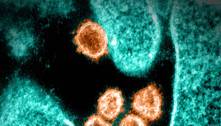 Cientistas descobrem método que impede totalmente a infecção pelo coronavírus