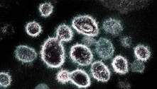Cientistas encontram coronavírus na gengiva de pacientes