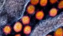 Composto testado na USP reduz inflamação da Covid-19 sem comprometer a resposta imune ao vírus 