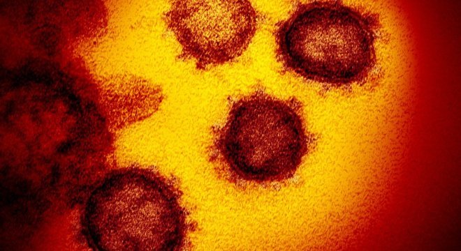 O Sars-Cov-2 utiliza proteínas em forma de espinho para aderir às células humanas que ataca.