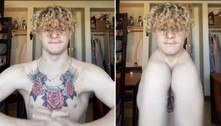 Rapaz sem clavícula usa ombros para 'bater palmas' e viraliza no TikTok