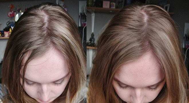 Shampoo a seco - como usar, qual escolher e melhores produtos