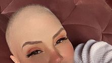 Simony mostra cabelo branco crescendo após quimioterapia: 'Meu dia de renascimento' 