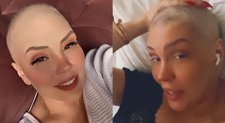 Simony mostra cabelo branco crescendo após quimioterapia
