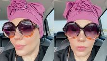 Simony usa turbante em meio a tratamento contra o câncer