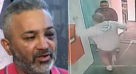 Síndico é agredido por morador após desentendimento sobre academia do prédio  em SP - Notícias - R7 São Paulo