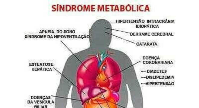 Síndrome metabólica