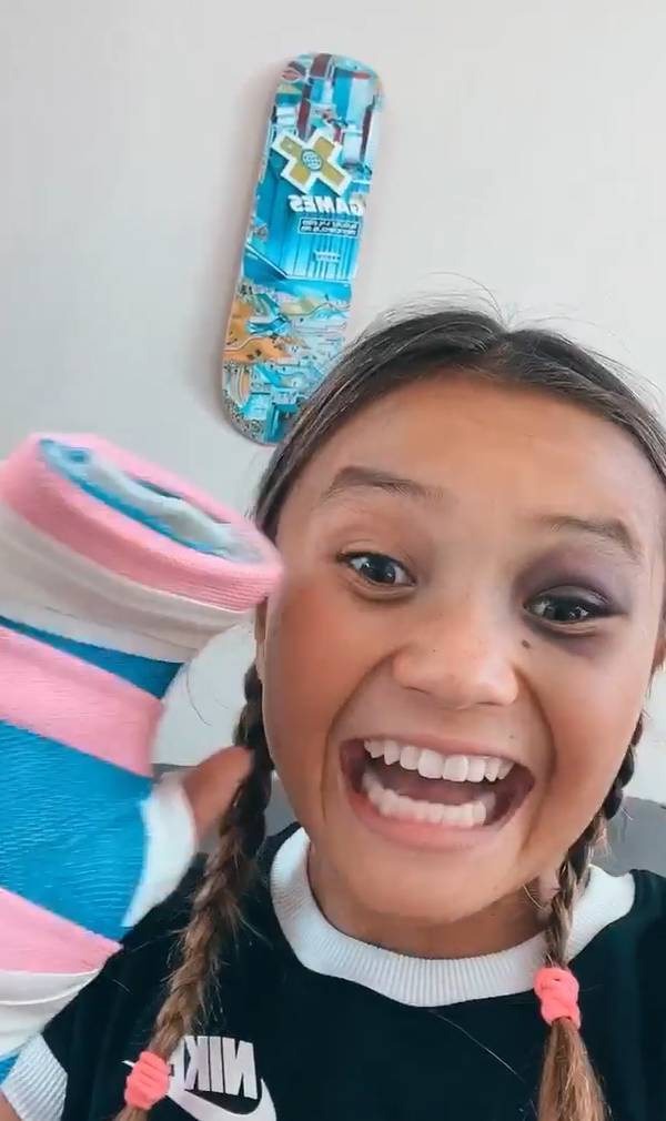 Queda de Sky Brown abre discussão da idade mínima para praticar skate