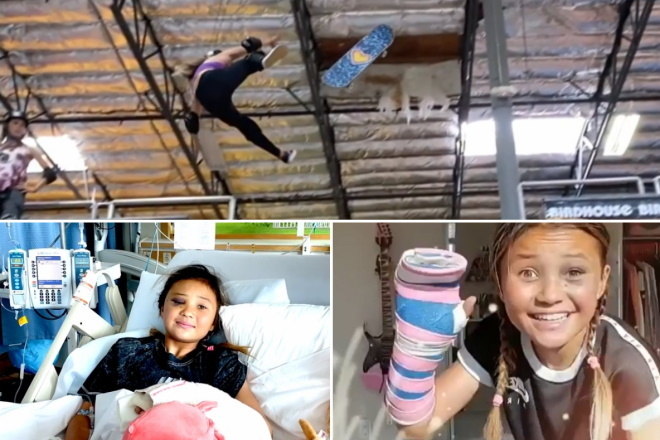 A skatista Sky Brown já está em casa, recuperada, ansiosa para voltar a andar de skate. A menina de 11 anos sofreu um grave acidente enquanto treinava na última segunda-feira (1). Por enquanto ela ainda não pode voltar a praticar o esporte. Ela é uma das grandes promessas da modalidade e defende o Reino Unido