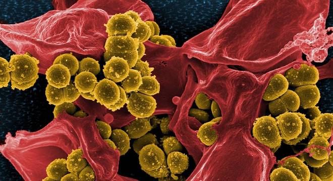 Staphylococcus aureus (em amarelo) muitas vezes é resistente a antibióticos