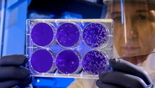 Fiocruz: detecção de bactérias resistentes triplicou na pandemia 