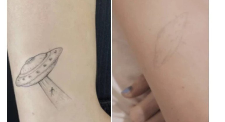 Fotos da mesma tatuagem: a primeira tirada após 1 mês e a segunda após 9 meses