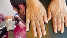 Artista tatua unha realista em pianista que perdeu parte do dedo