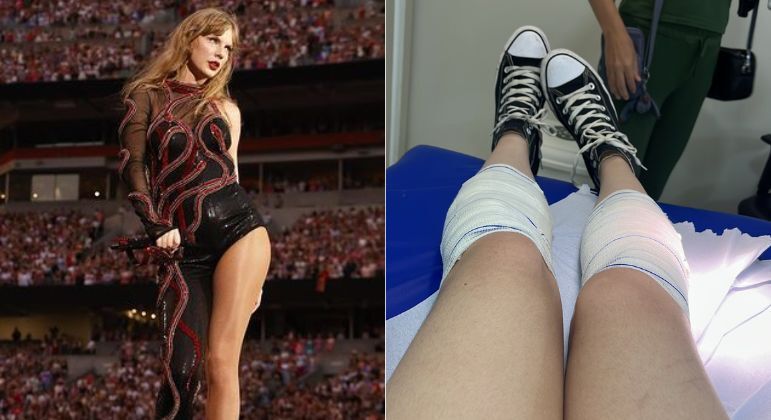 Fã de Taylor Swift sofre queimadura em estádio