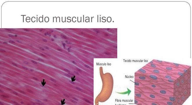 Tecido muscular, o que é? Definição, características e os 3 tipos