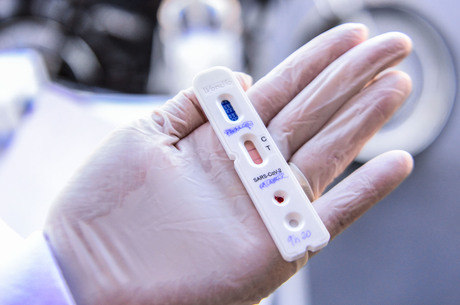 Testes rápidos detectam anticorpos 
