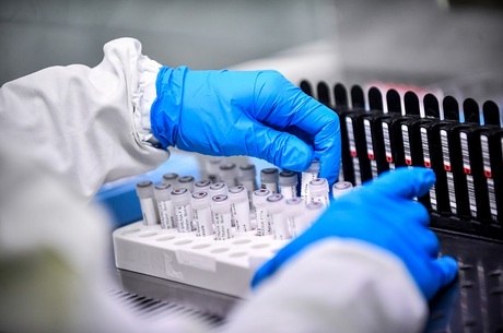 Laboratórios recebem cerca de 1.400 amostras/dia