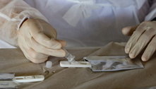 Fiocruz pede à Anvisa registro de novo teste único de Covid e gripe