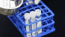 Variante Ômicron não dá sinais de causar casos mais graves de Covid
