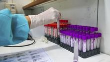Maioria dos laboratórios de SP tem problema para repor teste de Covid 