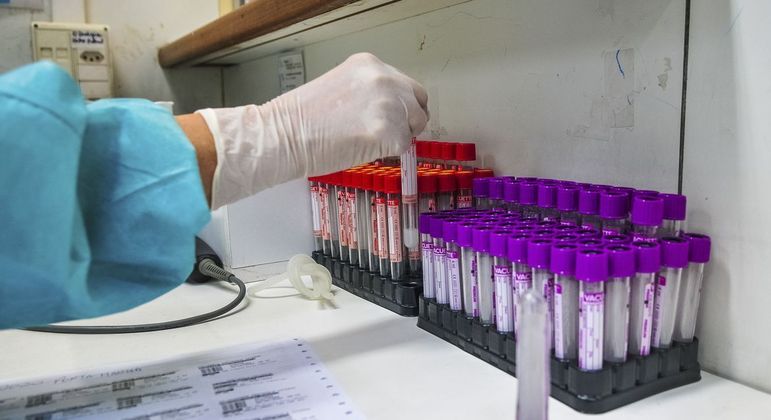 Pesquisa revela que a maioria dos laboratórios tem dificuldade para repor testes
