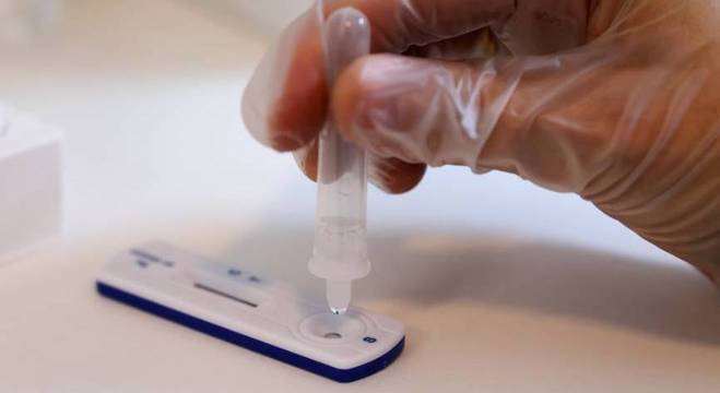 Químico realiza teste rápido de antígeno em farmácia na França