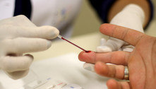 Prevalência de HIV dobra em 20 anos no Brasil, aponta ONU