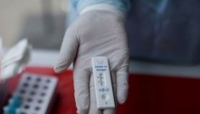 Testes rápidos de Covid têm maior risco de falso negativo 