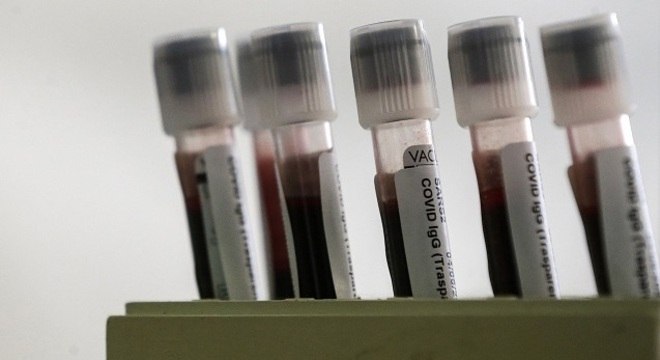 Segundo inquérito sorológico prevê analise de 1.900 pessoas infectadas 