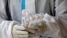 USP lançará teste PCR específico para variante brasileira da covid 