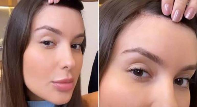 Thais Braz fez cirurgia para diminuir o tamanho da testa em março deste ano