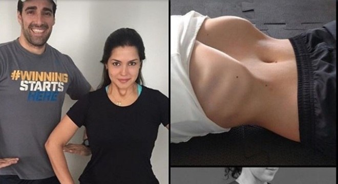 thais-fersoza-cirurgia-diastase