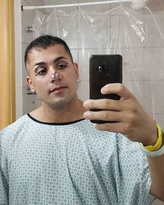 Em 2020, Tiago passou por vários procedimentos estéticos e, nas redes sociais, chegou a exibir o rosto marcado pré-cirurgia. Vale lembrar que em 2015 ele já tinha aplicado botox no lábio Em 2020, Tiago passou por vários procedimentos estéticos e, nas redes sociais, chegou a exibir o rosto marcado pré-cirurgia. Vale lembrar que em 2015 ele já tinha aplicado botox no lábio