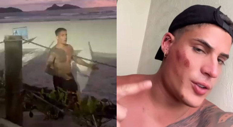 Tiago Ramos mostra machucado no rosto após brigar em praia do Rio