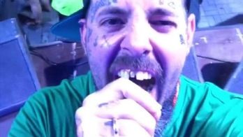 Tico Santa Cruz se empolga e quebra dente durante show. Veja o vídeo (Reprodução/Instagram)