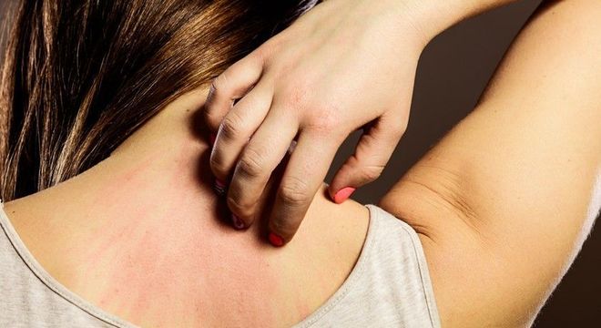 Tipos de alergia, quais são? Principais características e exemplos