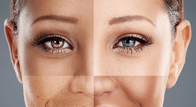 Tipos de pele - quais são, como identificar e cuidar