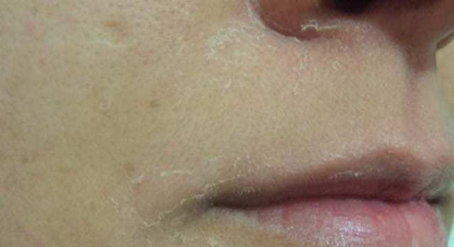 Tipos de pele - quais são, como identificar e cuidar