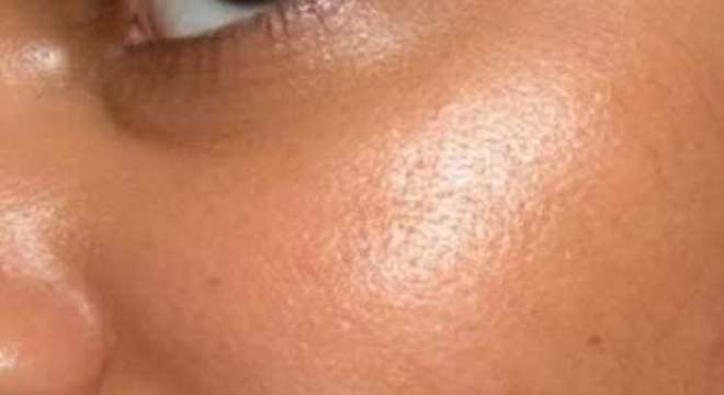 Tipos de pele - quais são, como identificar e cuidar