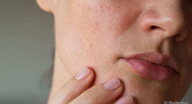 Tipos de pele - quais são, como identificar e cuidar