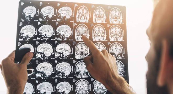 Com uso da inteligência artificial, diagnóstico por imagem se torna mais eficiente
