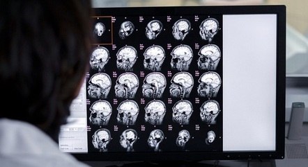 Tecnologia se mostrou promissora para eliminar tumores cerebrais