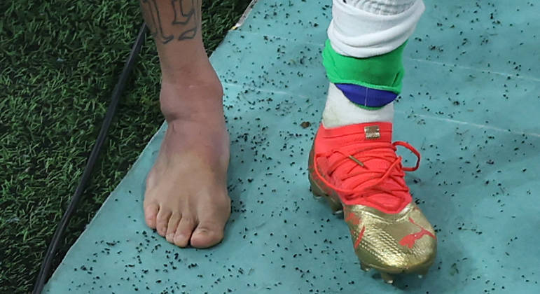 Tornozelo direito de Neymar inchado após atacante sofrer entorse na estreia do Brasil na Copa