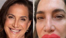 Totia Meirelles aparece com bocão e ironiza: 'Nada como uma harmonização facial bem-feita'
