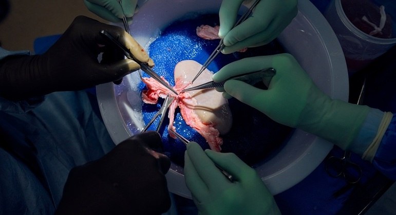 Órgãos de porcos podem ser uma solução para as longas filas de transplantes